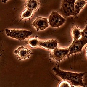 HeLa Cells with Phase Contrast