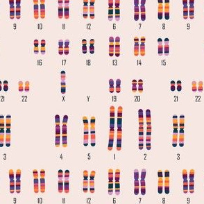 Karyotype X (Turner Syndrome)