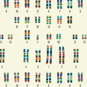 Karyotype XXY (Klinefelter Syndrome)