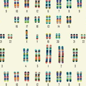 Karyotype XY Trisomy 21 (Down Syndrome, Male)