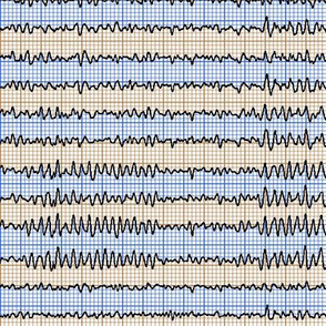 EEG in blue and brown