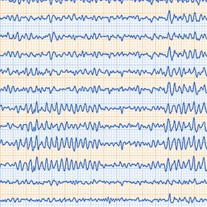 EEG in blue and tan