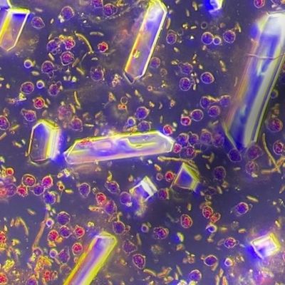 Real Lab microscopy with bacteria, cells and crystals