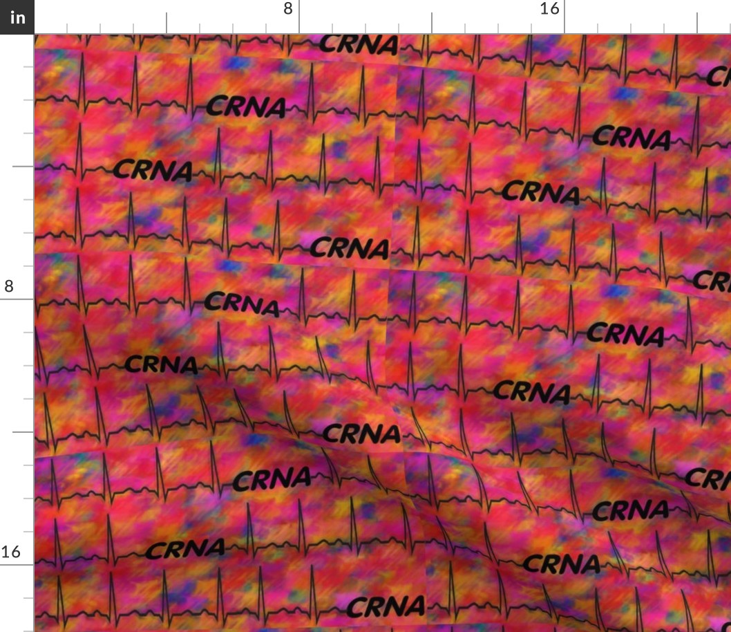 CRNA Cardiac Rhythm