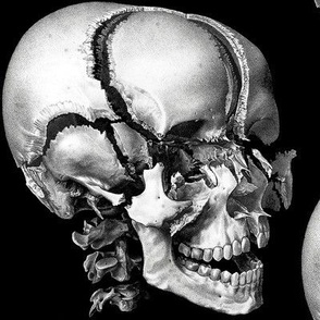 2 black fractured break shatter smash human skulls anatomy vintage white monochrome horror eerie macabre spooky bizarre morbid anatomical studies death biology gothic exploded