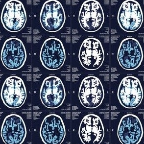 Brain Scans