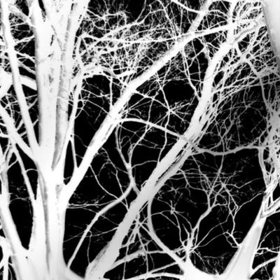 The Tree Lace ~ White and Black