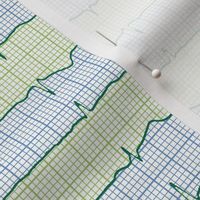 EKG:  a chevron from the heart