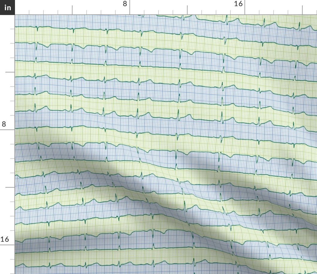 EKG:  a chevron from the heart