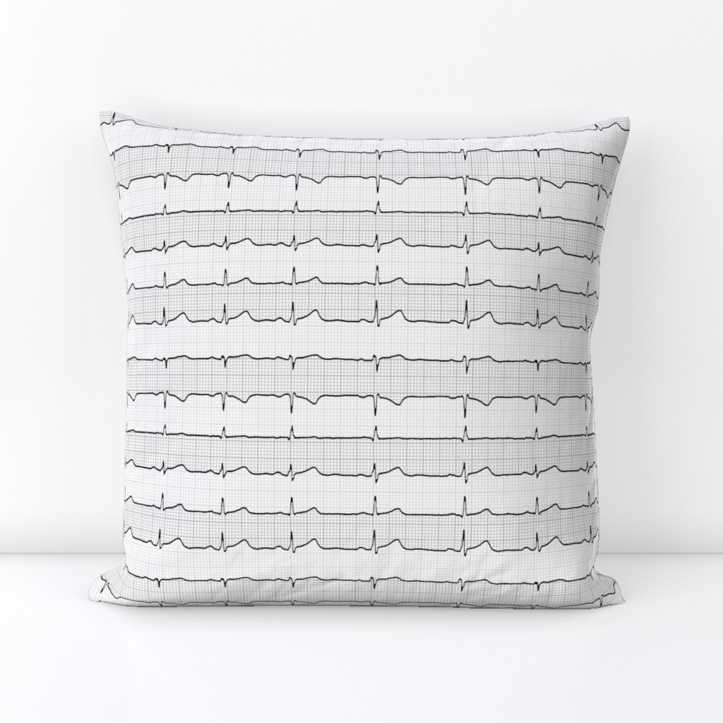 EKG:  a chevron from the heart (grey)