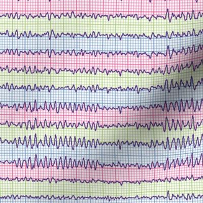 EEG:  chevrons of the mind