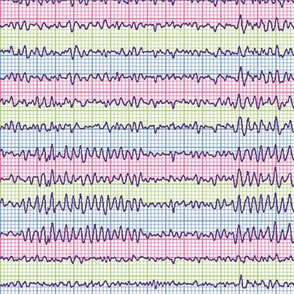 EEG:  chevrons of the mind