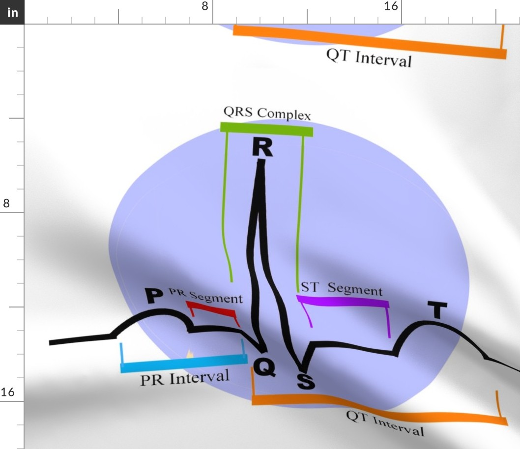 Cardiac Rhythm ST Segment