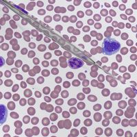 Wright-Stained Peripheral Blood, Normal