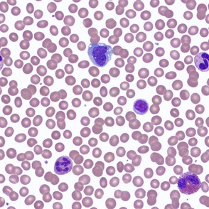 Wright-Stained Peripheral Blood, Normal