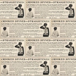 1915 deformed spine cure ad