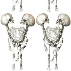 skulls skeletons death anatomy vintage black white monochrome eerie macabre spooky bizarre morbid anatomical studies  conjoined twins Siamese siblings
