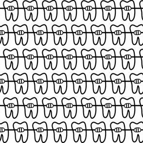 Ortho / braces teeth black and white small rdh  
