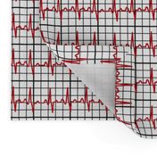 heartbeat readout