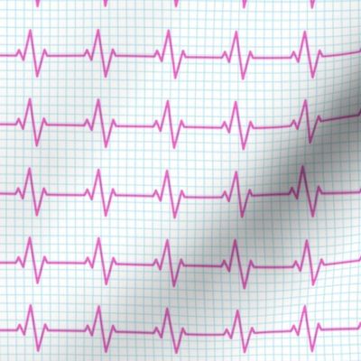 EKG - heart beat - sinus rhythm - pink on blue - LAD19