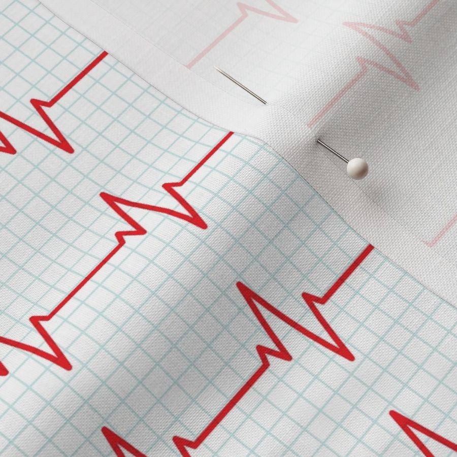 EKG - heart beat - sinus rhythm - red  on blue - LAD19