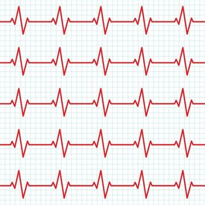 EKG - heart beat - sinus rhythm - red  on blue - LAD19