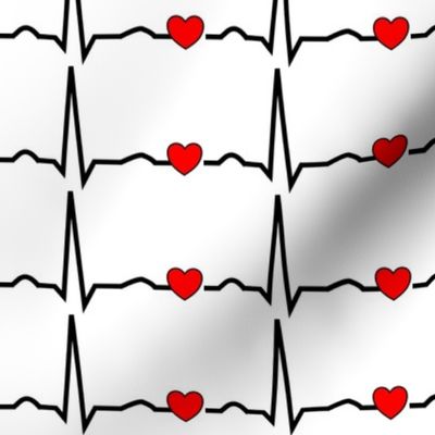 Cardiac Rhythm