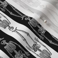 Skeleton Illustrations with Black & White Stripes (Small Scale)